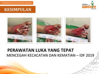 Comprehensive Multidisciplinary Approach to Diabetic Foot Ulcer Care ...