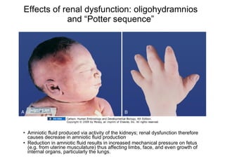 Effects of renal dysfunction: oligohydramnios and “Potter sequence” Amniotic fluid produced via activity of the kidneys; renal dysfunction therefore causes decrease in amniotic fluid production Reduction in amniotic fluid results in increased mechanical pressure on fetus (e.g. from uterine musculature) thus affecting limbs, face, and even growth of internal organs, particularly the lungs. 