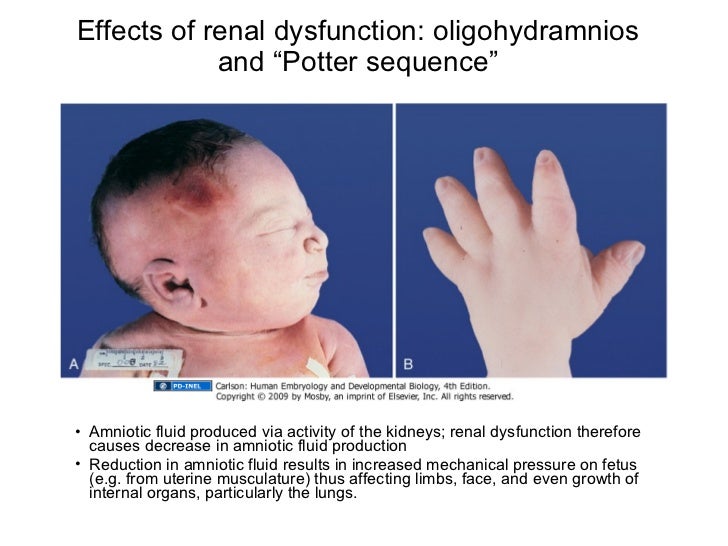 05.28.09(b) Development of the Urinary System