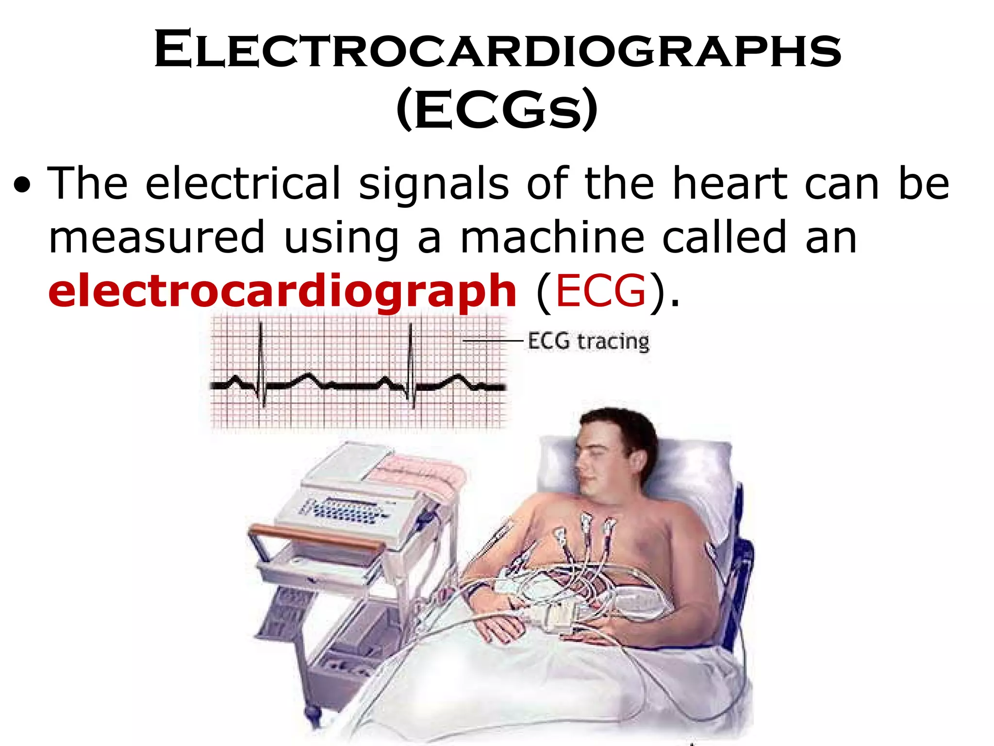 Electrocardiographs (ECGs) The electrical signals of the heart can be measured using a machine called an  electrocardiograph  ( ECG ). 