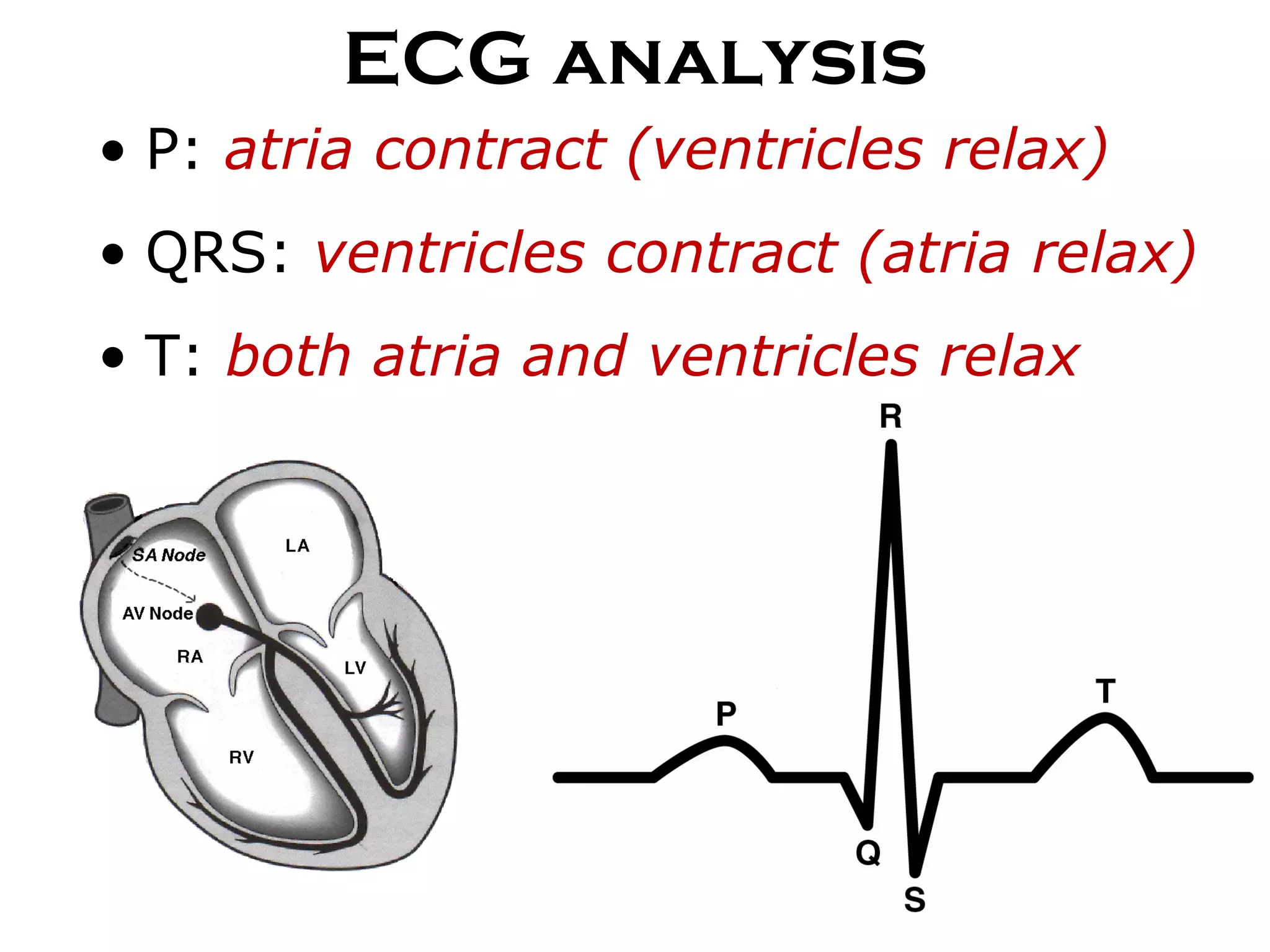 ECG analysis P:  atria contract (ventricles relax) QRS:  ventricles contract (atria relax) T:  both atria and ventricles relax 