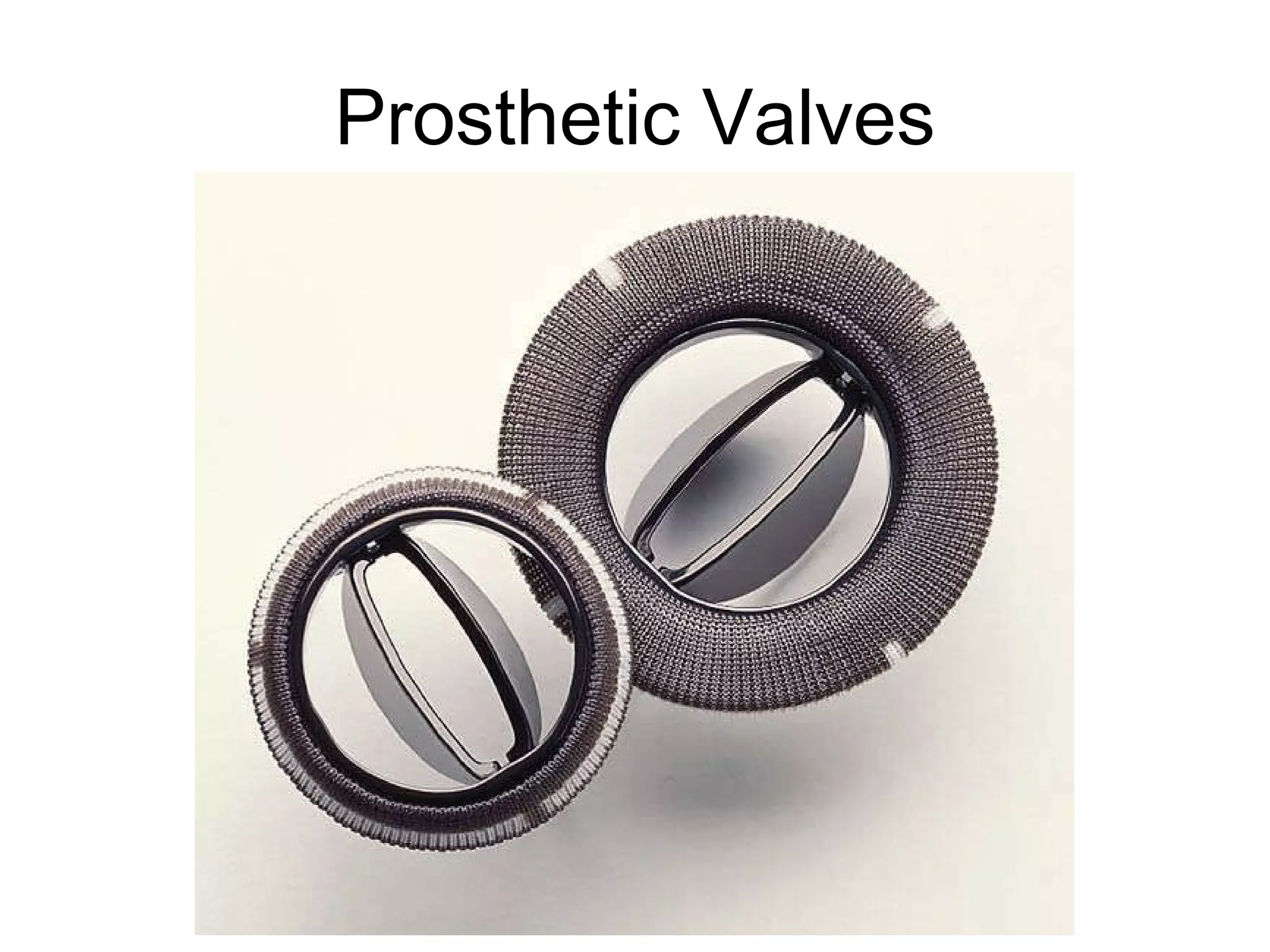 Prosthetic Valves 