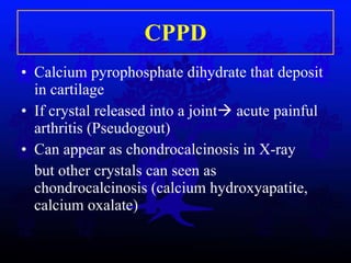 CPPD Calcium pyrophosphate dihydrate that deposit in cartilage If crystal released into a joint   acute painful arthritis (Pseudogout) Can appear as chondrocalcinosis in X-ray but other crystals can seen as chondrocalcinosis (calcium hydroxyapatite, calcium oxalate)  