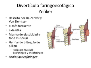 Divertículo faringoesofágico
                    Zenker
• Descrito por Dr. Zenker y
  Von Ziemssen
• El más frecuente
• > de 60 a
• Merma de elasticidad y
  tono muscular
• Herniando triángulo de
  Killian
   – Fibras de músculo
     tirofaríngeo y cricofaríngeo
• Acalasiacricofaríngea
 