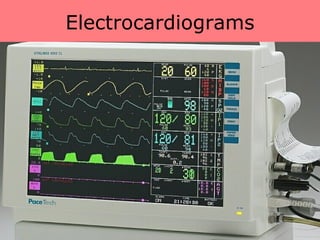 Electrocardiograms 