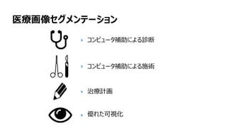医療画像セグメンテーション
コンピュータ補助による診断
コンピュータ補助による施術
治療計画
優れた可視化
 