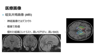 145
医療画像
磁気共鳴画像 (MRI)
神経画像ではデファクト
複雑で高価
優れた組織コントラスト、高いリアリティ、高いSN比
 