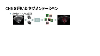 148
CNNを用いたセグメンテーション
ボクセルベースの分類
 