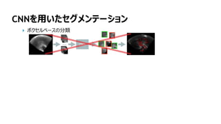 149
CNNを用いたセグメンテーション
ボクセルベースの分類
 