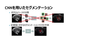 150
CNNを用いたセグメンテーション
ボクセルベースの分類
全領域に対するセグメンテーションマスクの予測
 