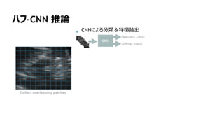 154
ハフ-CNN 推論
CNNによる分類＆特徴抽出
 
