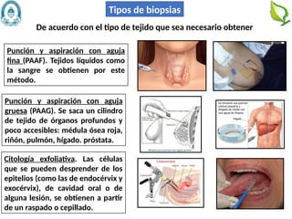 78
Punción y aspiración con aguja
fina (PAAF). Tejidos líquidos como
la sangre se obtienen por este
método.
Tipos de biopsias
De acuerdo con el tipo de tejido que sea necesario obtener
Punción y aspiración con aguja
gruesa (PAAG). Se saca un cilindro
de tejido de órganos profundos y
poco accesibles: médula ósea roja,
riñón, pulmón, hígado. próstata.
Citología exfoliativa. Las células
que se pueden desprender de los
epitelios (como las de endocérvix y
exocérvix), de cavidad oral o de
alguna lesión, se obtienen a partir
de un raspado o cepillado.
 