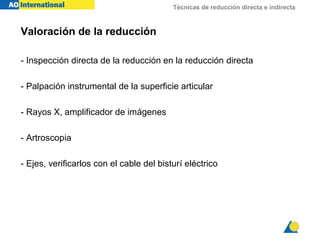 Técnicas de reducción directa e indirecta
Valoración de la reducción
- Inspección directa de la reducción en la reducción directa
- Palpación instrumental de la superficie articular
- Rayos X, amplificador de imágenes
- Artroscopia
- Ejes, verificarlos con el cable del bisturí eléctrico
 