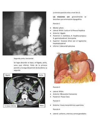 Segundo corte, horizontal. 
Se logra describir el bazo, el hígado, aorta, 
vena cava inferior. Parte de la primera 
porción, y la segunda porción de duodeno. La 
segunda 
La tercera porción esta a nivel de L3. 
Las relaciones son: generalmente se 
describen pro orientación topográfica. 
Porción 1 
 Medial: píloro 
 Lateral: Riñón. Justo en la flexura hepática 
 Anterior: Hígado 
 Posterior: C. Colédoco, A. hepática propia y 
A. gastroduodenal, Vena porta 
 Superior: Vesícula biliar con el ligamento 
hepatoduodenal 
 Inferior: Cabeza del páncreas 
Porción 2 
 Lateral: Riñón. 
 Anterior: Mesocolon transverso 
 Posterior: Psoas iliaco 
Porción 3 
 Anterior: Vasos mesentéricos superiores 
Porción 4 
 Lateral: uréteres, arterias y venas gonadales 
Aorta 
Hígado 
V. Cava inferior 
Bazo 
 