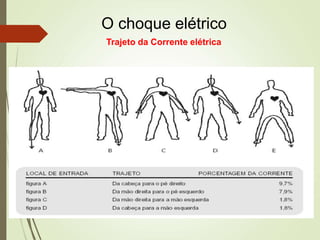 O choque elétrico
Trajeto da Corrente elétrica
 
