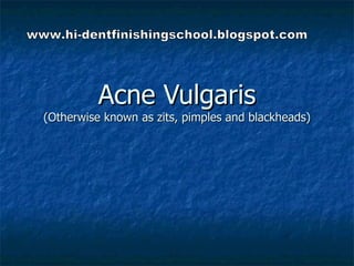 Acne Vulgaris (Otherwise known as zits, pimples and blackheads) www.hi-dentfinishingschool.blogspot.com 