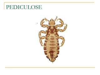 Pediculose (piolho)
PEDICULOSE
 