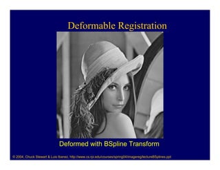 Deformable Registration




                              Deformed with BSpline Transform
© 2004, Chuck Stewart & Luis Ibanez, http://www.cs.rpi.edu/courses/spring04/imagereg/lectureBSplines.ppt
 