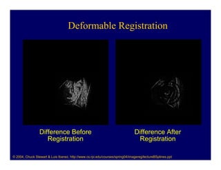 Deformable Registration




                 Difference Before                                             Difference After
                    Registration                                                Registration

© 2004, Chuck Stewart & Luis Ibanez, http://www.cs.rpi.edu/courses/spring04/imagereg/lectureBSplines.ppt
 