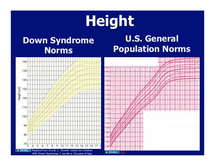 Down Syndrome Baby Growth Chart