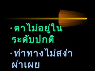 04/24/14
•ตำไม่อยู่ใน
ระดับปกติ
•ท่ำทำงไม่สง่ำ
ผ่ำเผย
 