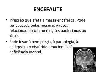 ENCEFALITE
• Infecção que afeta a massa encefálica. Pode
ser causada pelas mesmas viroses
relacionadas com meningites bacterianas ou
virais.
• Pode levar à hemiplegia, à paraplegia, à
epilepsia, ao distúrbio emocional e à
deficiência mental.
 