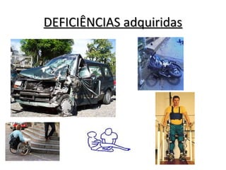 DEFICIÊNCIAS adquiridasDEFICIÊNCIAS adquiridas
 