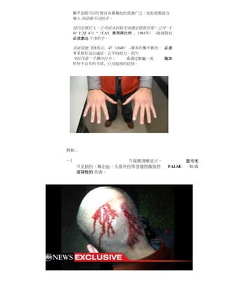 衡平法院可以行使自由裁量权的范围广泛，在拒绝帮助当
 事人 向法院不洁的手。

 纽约足球巨人，公司诉洛杉矶充电器足球俱乐部，公司，2
 91 F.2d 471 “（CA5. 密西西比州 ，1961年） -他成股权
 必须拿出 干净的手。

 贝诉荒地 228美元，47（1848） -要求在衡平救济， 必须
 有采取行动以诚信，公平的权力，因为
 可以代表一个欺诈行为，   或通过欺骗，或              施加
 任何不公平的手段，已经取得的优势。




例如：

一）               当视频清晰显示，                  显示无
     可见损伤，鼻出血，头部外伤等创建图像指控            FALSE  和/或
     误导性的 伤害：
 