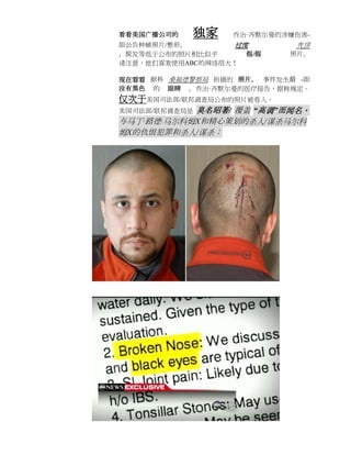 看看美国广播公司的   独家     乔治·齐默尔曼的涉嫌伤害-
即公告种植照片/整形，        过度        秃顶
，脱发等低于公布的照片相比似乎      假/假    照片。
请注意，他们喜欢使用ABC的网络很大！

现在看看 据称 桑福德警察局 拍摄的 照片， 事件发生后 -即
没有黑色 的 眼睛 ，乔治·齐默尔曼的医疗报告，据称规定。
仅次于美国司法部/联邦调查局公布的照片被卷入。
           臭名昭著/ 覆盖 “高调”而闻名，
美国司法部/联邦调查局是
与马丁·路德·马尔科姆X和精心策划的杀人/谋杀马尔科
姆X的仇恨犯罪和杀人/谋杀：
 