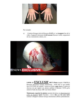 Par exemple:

a)    Création d'images tirés de blessures FAUX et / ou trompeur lors de la
     vidéo, il apparaît clairement révélé aucune blessure visible, saignement
     de nez, traumatisme crânien, etc:




     LOOK AT     EXCLUSIF                ABC'S Photo truquée / FAUX de
     blessures présumées George Zimmerman - AVIS dire ce qui semble
     être CULTURE de la photo / remise en forme, trop chauve, la perte de
     cheveux etc par rapport aux photos publiées ci-dessous. AVIS qu'ils
     aiment à l'aide du réseau ABC une bonne affaire!

     Maintenant, regardez les photos auraient été prises au département de
     police de Sanford Après l'incident - c'est à dire pas les yeux noirs
     comme le Rapport médical George Zimmerman affirme prétendument.
 