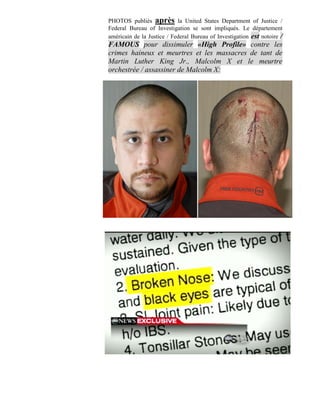 PHOTOS publiés après la United States Department of Justice /
Federal Bureau of Investigation se sont impliqués. Le département
américain de la Justice / Federal Bureau of Investigation est notoire /
FAMOUS pour dissimuler «High Profile» contre les
crimes haineux et meurtres et les massacres de tant de
Martin Luther King Jr., Malcolm X et le meurtre
orchestrée / assassiner de Malcolm X:
 