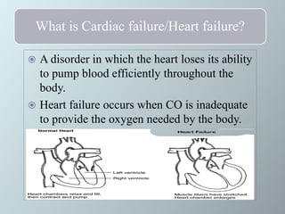 Heart Failure | PPTX
