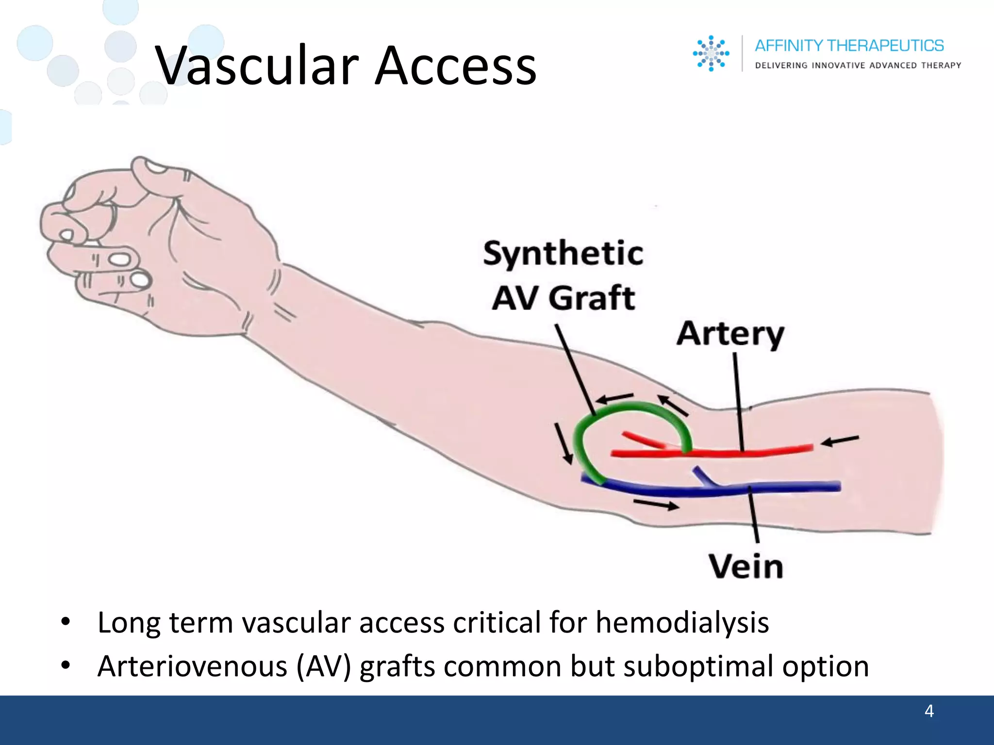 Vascular Access 
•Long term vascular access critical for hemodialysis 
•Arteriovenous (AV) grafts common but suboptimal option 
4 
 