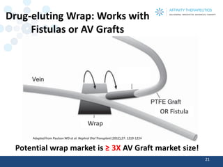 Drug-eluting Wrap: Works with 
Fistulas or AV Grafts 
21 
Wrap 
Adapted from Paulson WD et al. Nephrol Dial Transplant (2012);27: 1219-1224 
OR Fistula 
Potential wrap market is ≥ 3X AV Graft market size! 
 