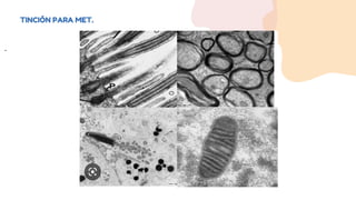 TINCIÓN PARA MET.
.
 
