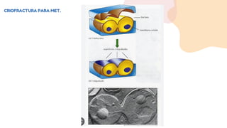 CRIOFRACTURA PARA MET.
 