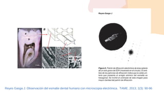 Reyes Gasga J. Observación del esmalte dental humano con microscopia electrónica. TAME. 2013; 1(3): 90-96
 