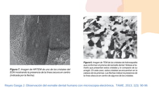 Reyes Gasga J. Observación del esmalte dental humano con microscopia electrónica. TAME. 2013; 1(3): 90-96
 