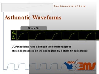 05 capnography hottopics 3_08_quiz | PPT