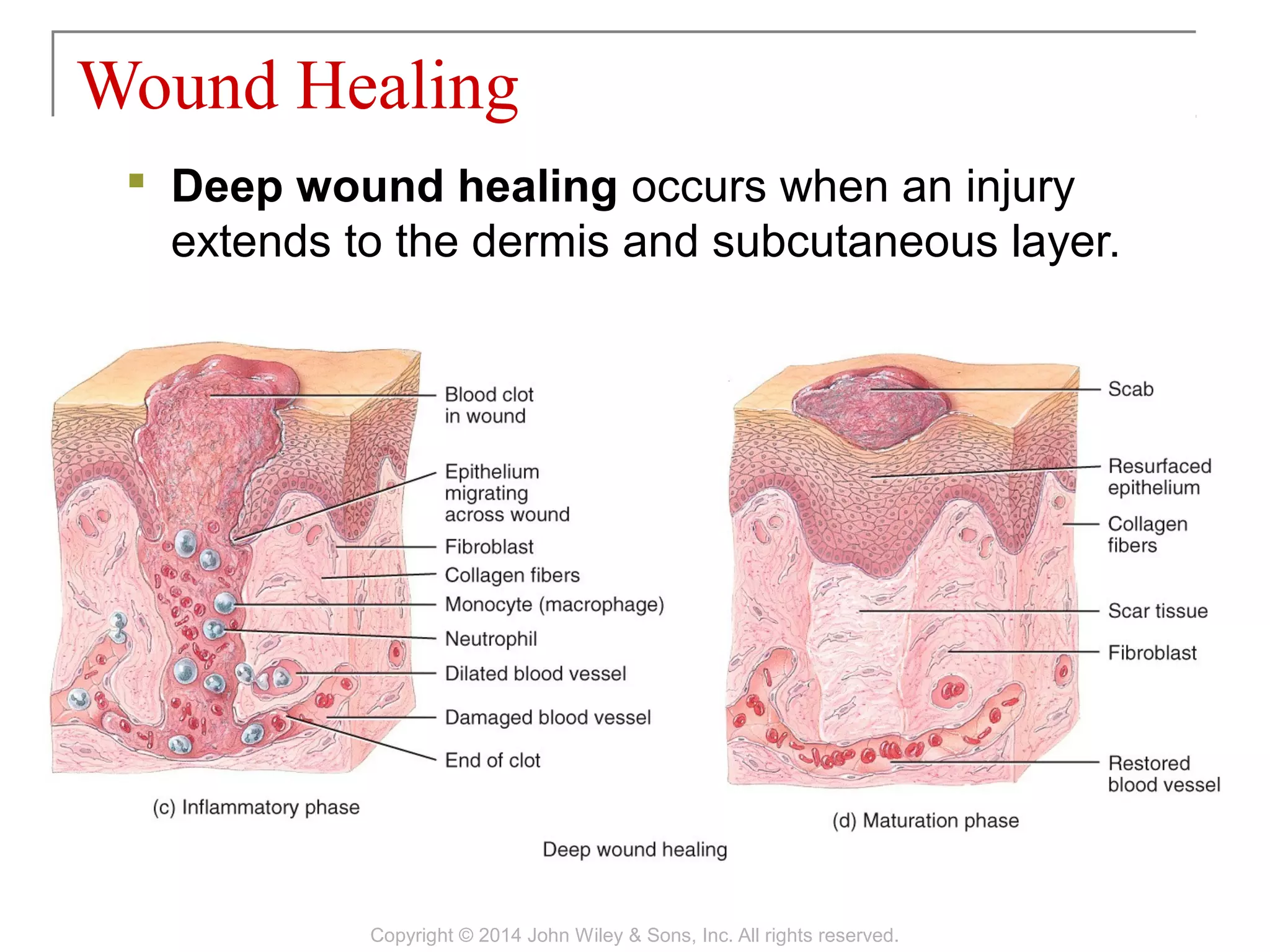 05 [chapter 5 the integumentary system] | PPT