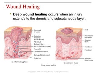 05 [chapter 5 the integumentary system] | PPT