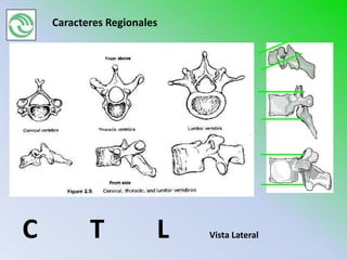 Caracteres Regionales




C          T            L   Vista Lateral
 