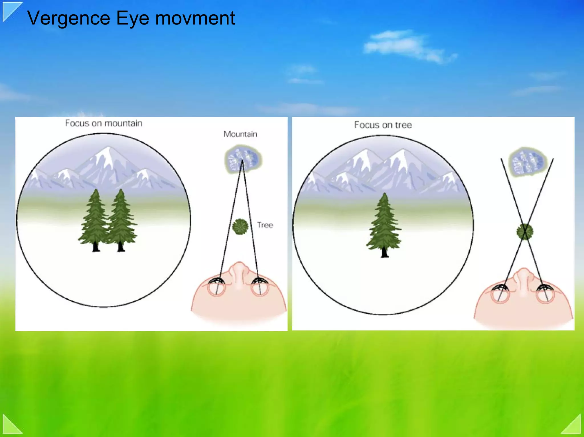 Vergence Eye movment
 