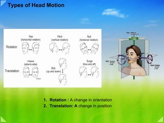 Types of Head Motion




            1. Rotation : A change in orientation
            2. Translation: A change in position
 