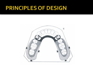 Direct retainers for Removable partial dentures 