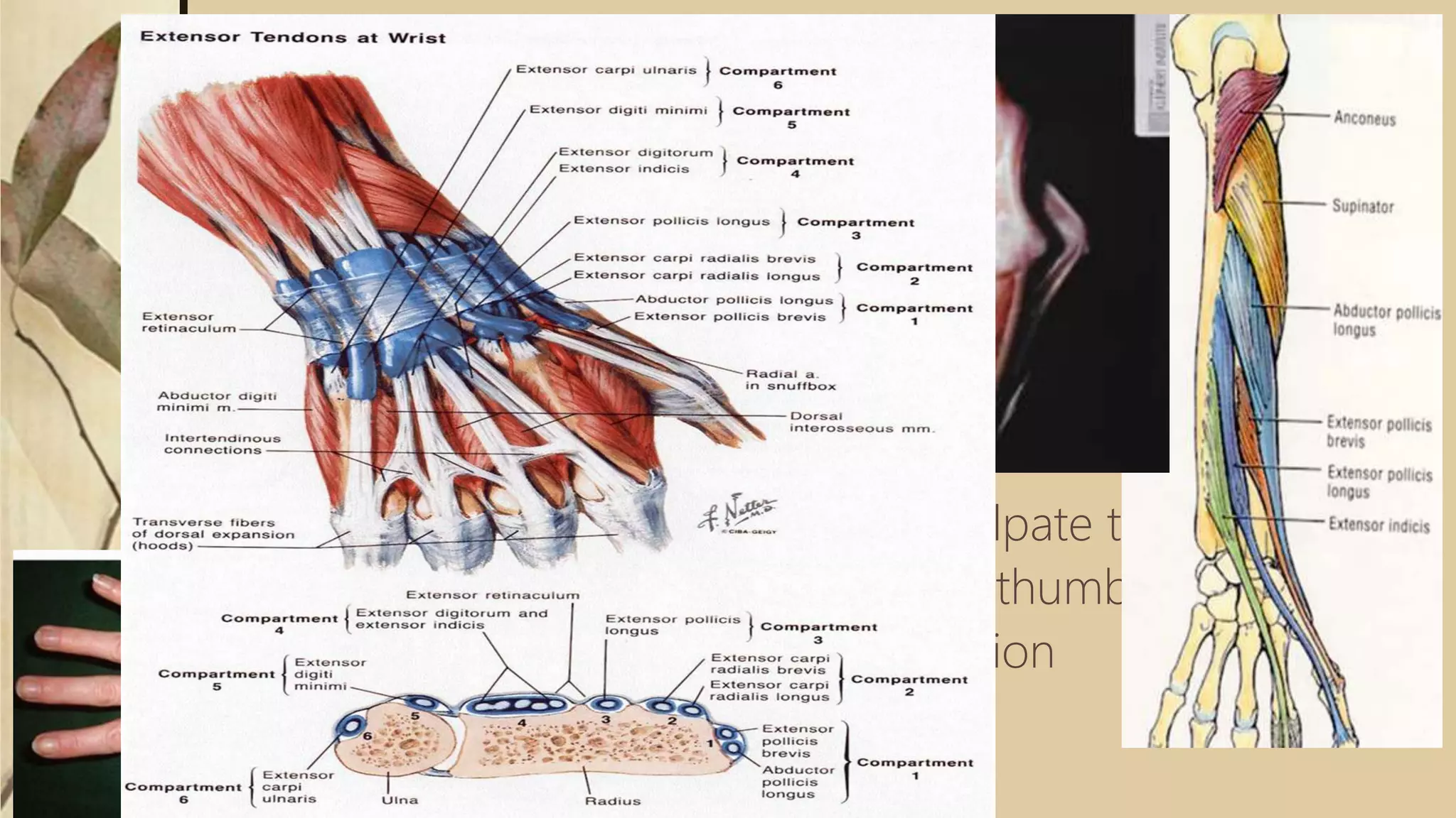 Thumb Extensors
 APL inserts on the metacarpal and radially abducts it
 EPB inserts on proximal phalanx and extends MCP Joint
 EPL inserts on distal phalanx and extends IP Joint
 Testing the Extrinsics:
 APL:Palpate with thumb abduction
 EPB:MP extension with IP flexion, palpate tendon
 EPL:Palpate tendon with retropulsed thumb
 EDC:Test with wrist in neutral-extension
 