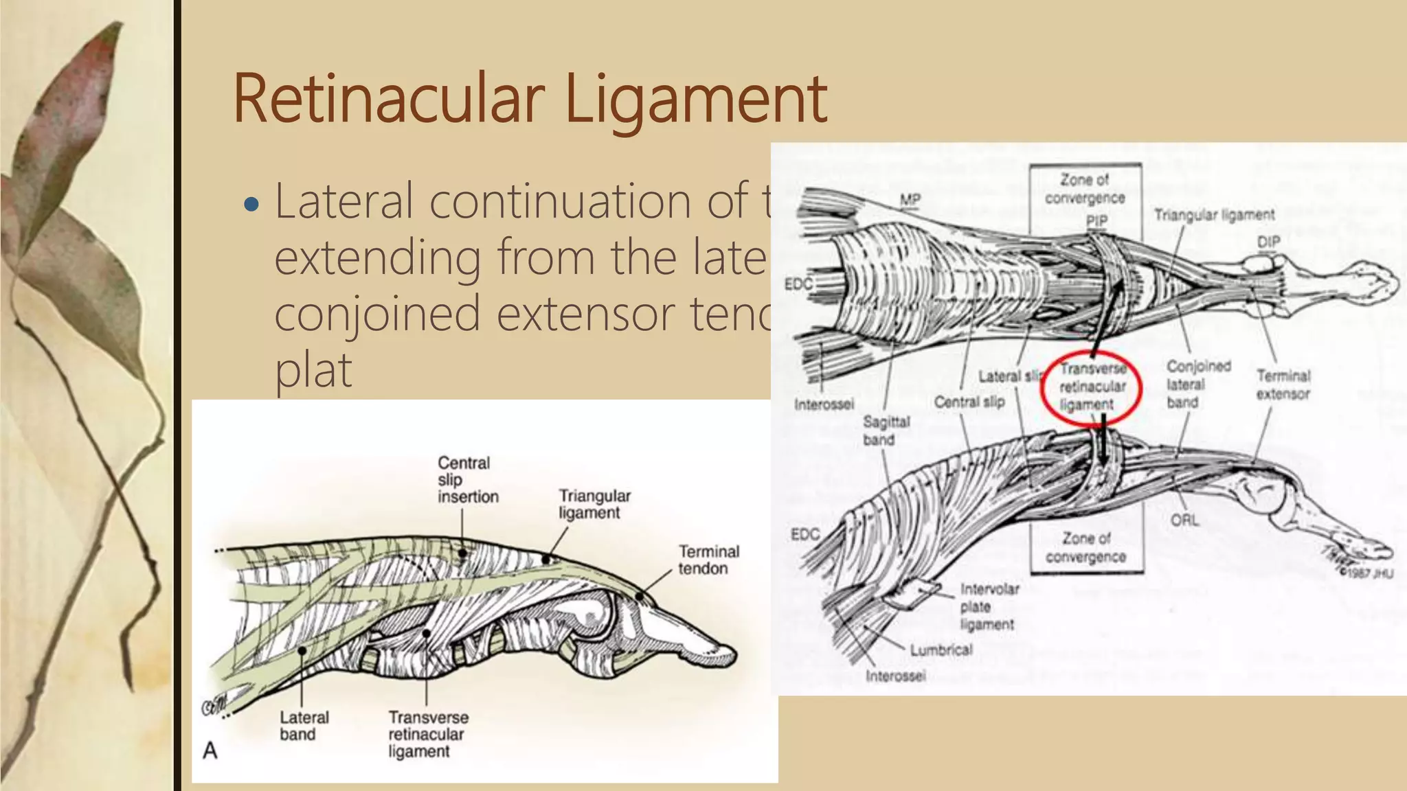 Retinacular Ligament
 Lateral continuation of the triangular ligament
extending from the lateral margin of the lateral
conjoined extensor tendon to PIPJ articular volar
plat
 