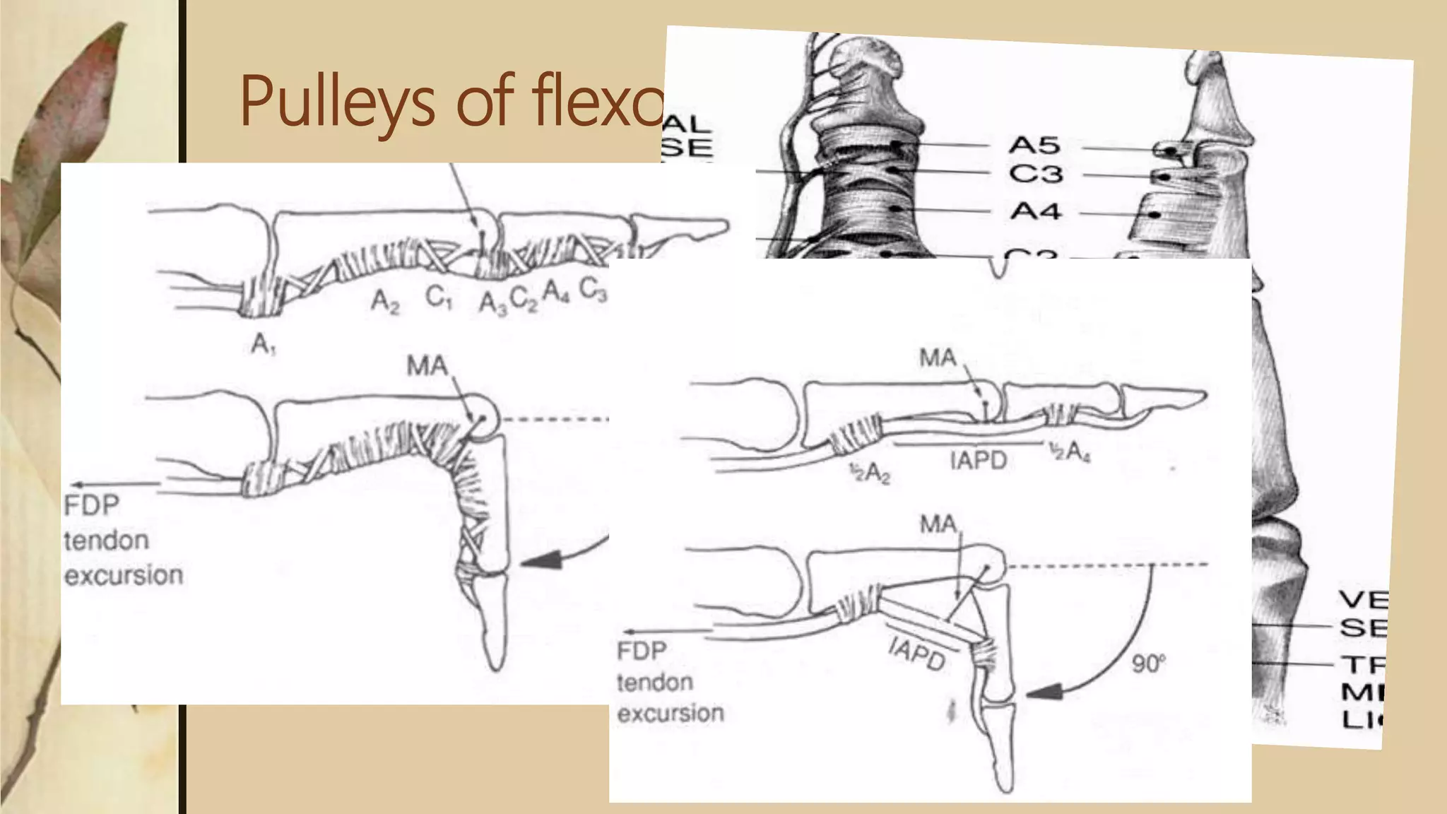 Pulleys of flexour
 Synovial sheath is reinforced by a system of fibrous pulleys
 5 annular pulleys (A) and
 3 Cruciform pulleys (C)
 A1: 8-10 mm over MCPJ
 A2: 18-20mm over proximal phalanx
 A3: 2-4 mm over PIPJ
 A4: 10-12mm over middle phalanx
 A5: 2-4 mm over DIPJ
 C1, C2, C3 proximal to A3, A4, A5
 Allow shortening of the pulley system in flexion
 A2 and A4 are considered most important. Their disruption
 leads to bowstringing, reduced mechanical efficiency and decreased flexion.
 Function: increase the mechanical efficiency by preventing bowstringing
 