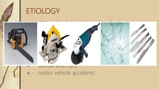 ETIOLOGY
 sharp object direct laceration (broken glass,
kitchen knives or table saws)
 crush injury
 avulsions
 burns
 animal or human bites
 suicide attempts
 motor vehicle accidents
 