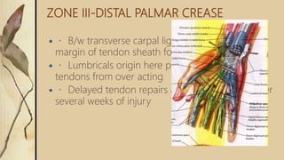 ZONE III-DISTAL PALMAR CREASE
 B/w transverse carpal ligament and proximal
margin of tendon sheath formation
 Lumbricals origin here prevents profundus
tendons from over acting
 Delayed tendon repairs are succesfull even after
several weeks of injury
 
